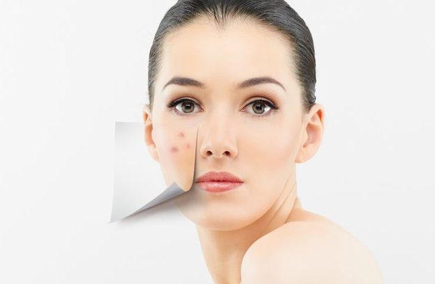 Proven and Safe Acne Treatment